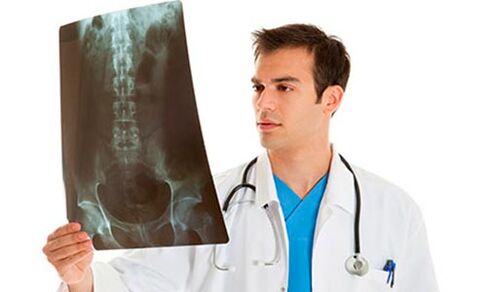medikuak erradiografia bat begiratzen du bizkarreko mina diagnostikatzeko