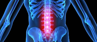 Deformazio intervertebral disc-ekin
